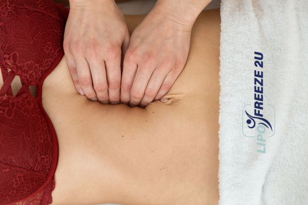 diastasis recti treatment Yeading