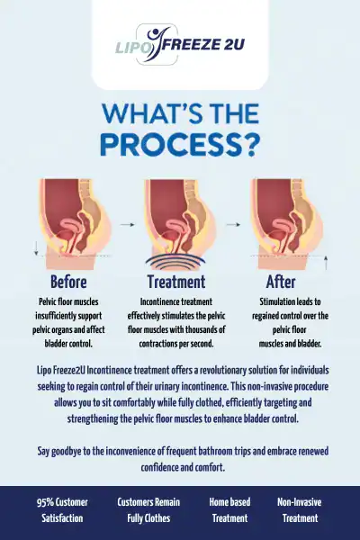 Diagram of how incontinence treatment Yeading works.