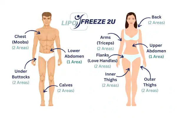 Areas you can have fat freezing treatment Yeading