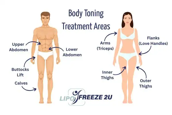 Graphic showing where you can have Body toning Treatment Yeading on your body