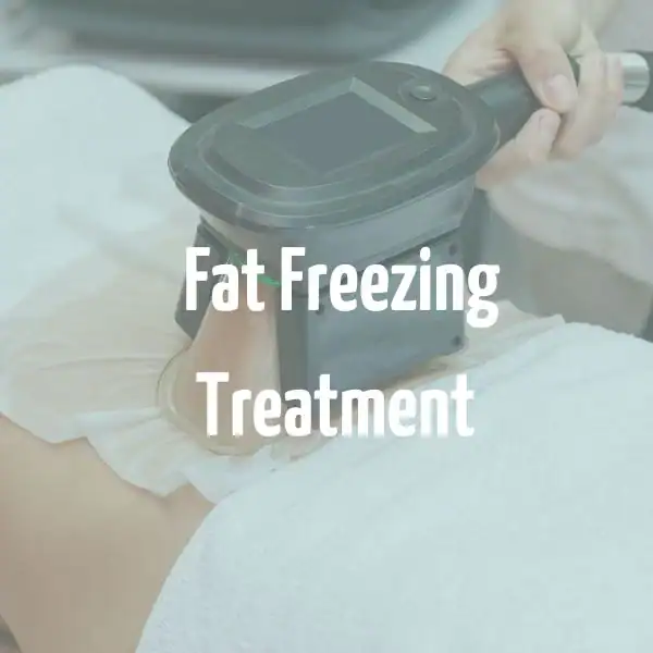 fat freezing treatment Yeading