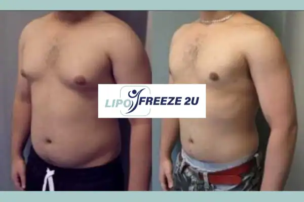 How Long Does It Take to See Results Yeading?