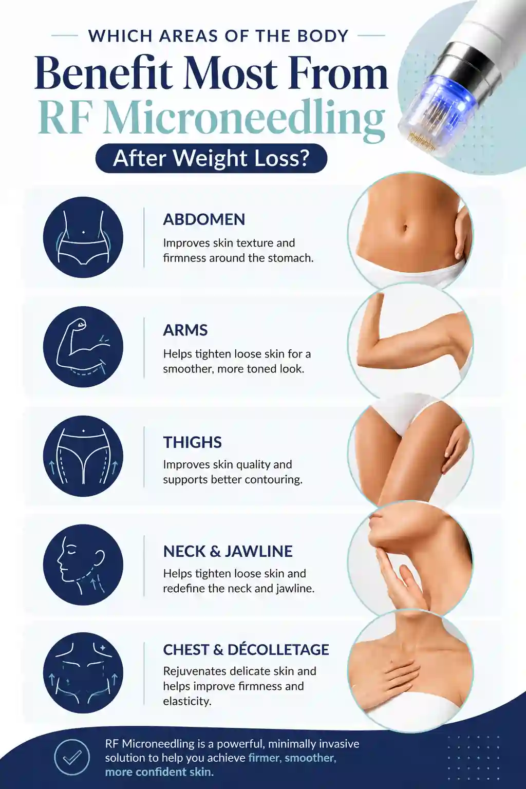 Which Areas of the Body Benefit Most From RF Microneedling After Weight Loss Yeading
