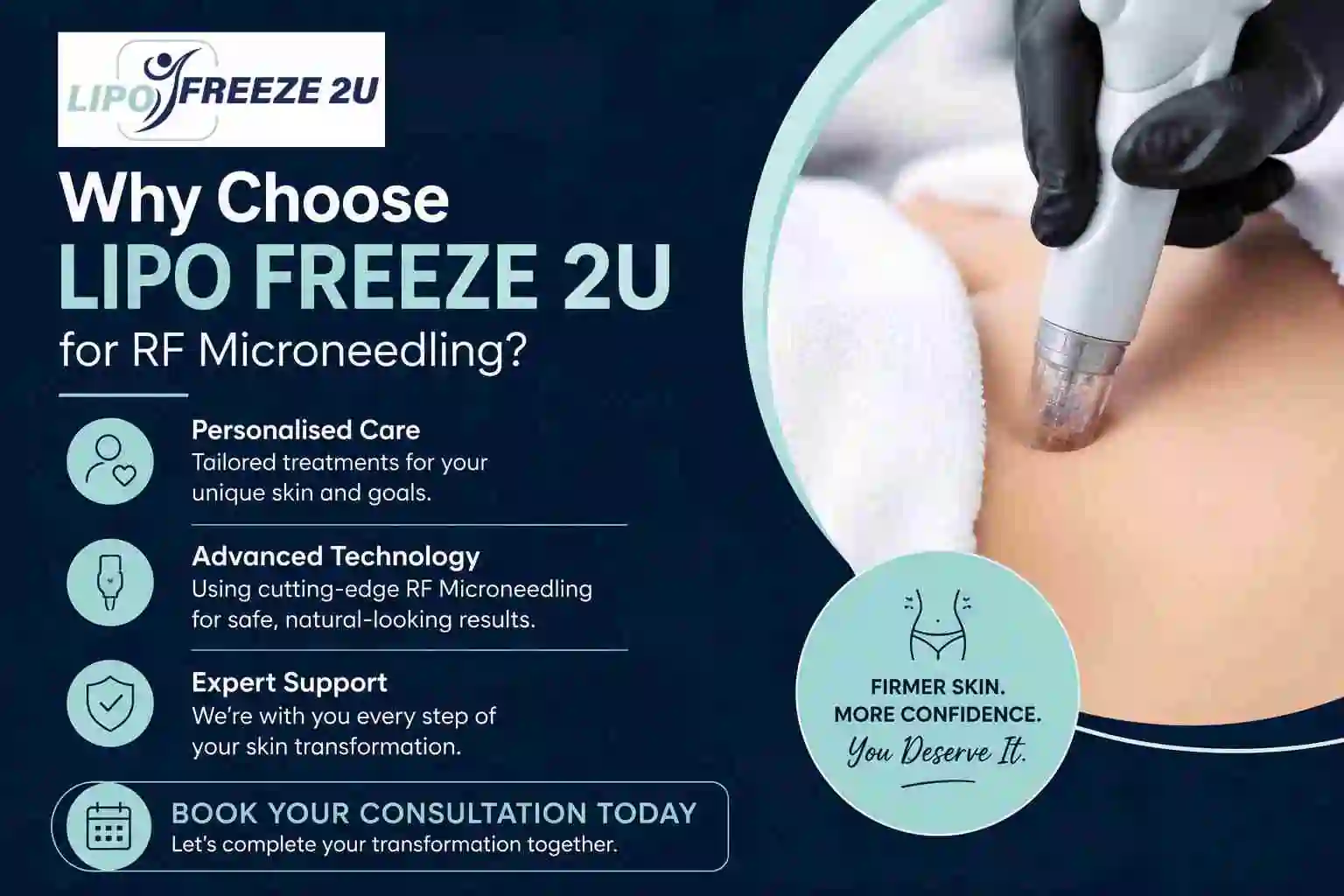 Why Choose LIPO FREEZE 2U for RF Microneedling Yeading?